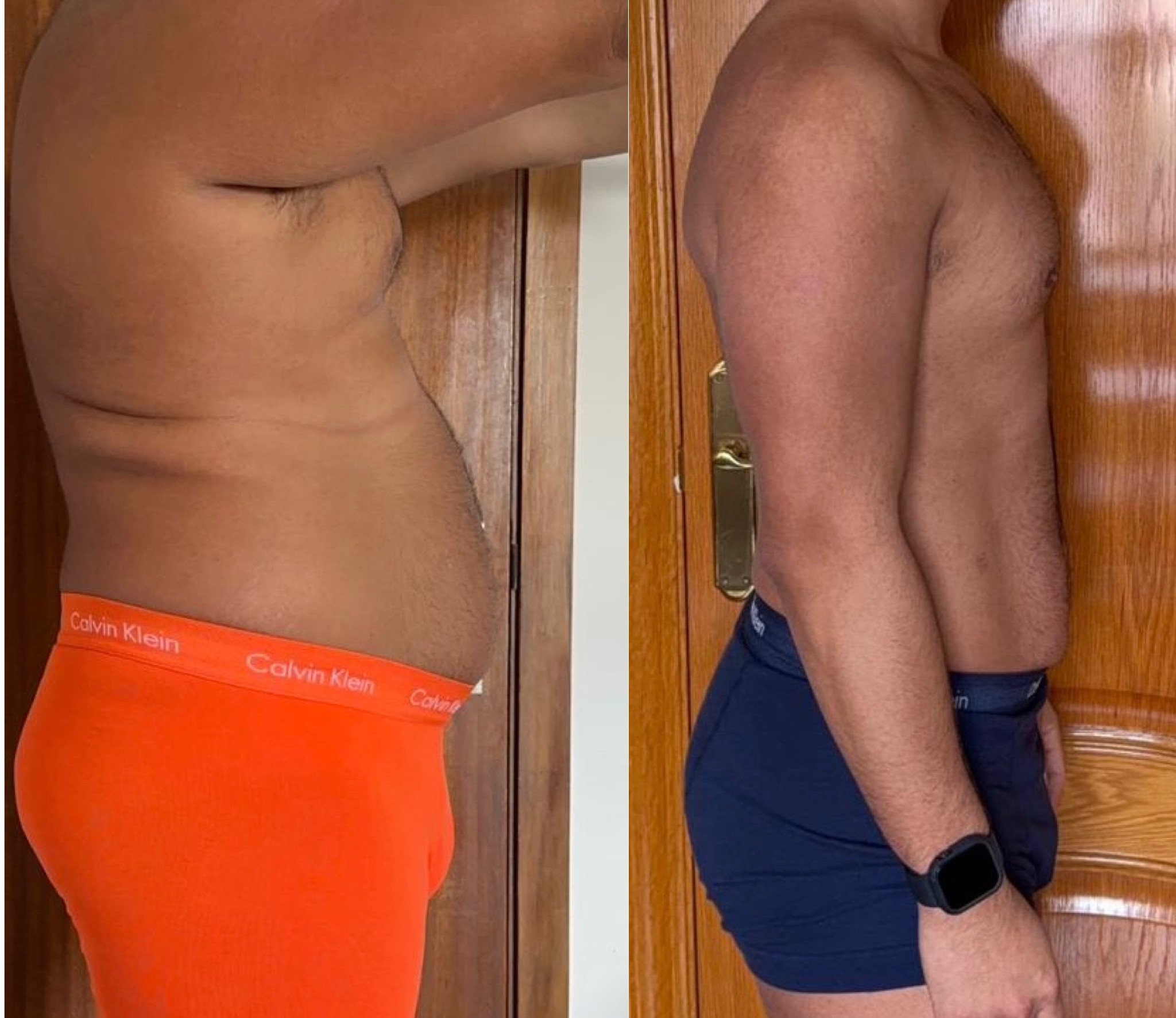 Transformación física del mismo cliente, vista de perfil, antes y después